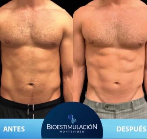 Resultado de tratamiento nutricional - Bioestimulación