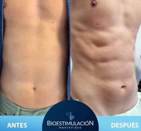 Resultado de nutrición personalizada - Bioestimulación