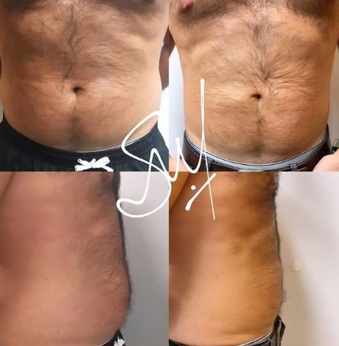 Resultado de plan nutricional - Bioestimulación