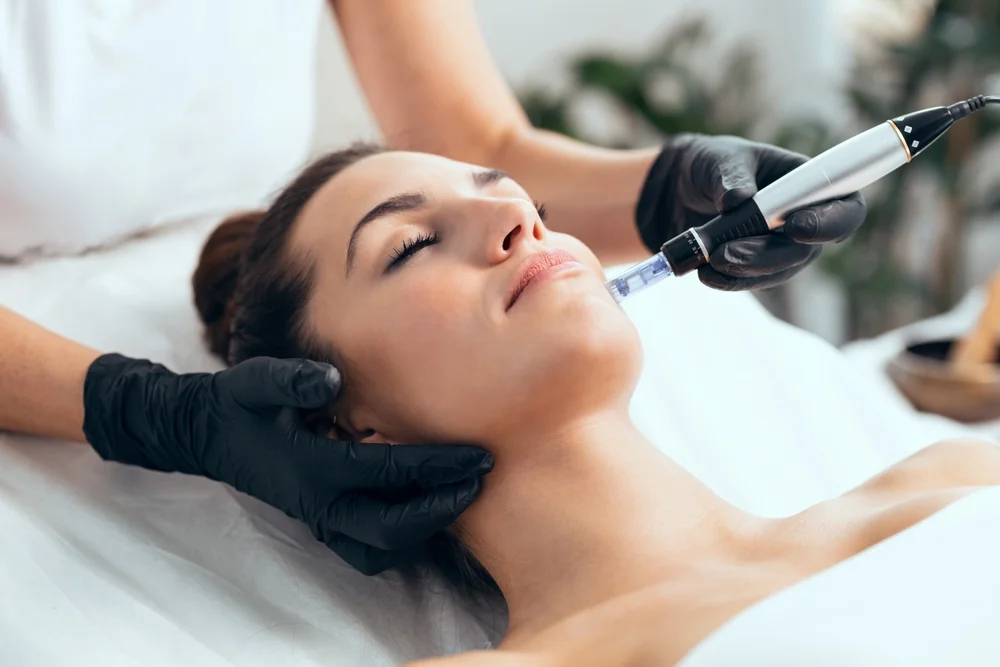 Tratamiento Dermapen en Montevideo – Bioestimulación