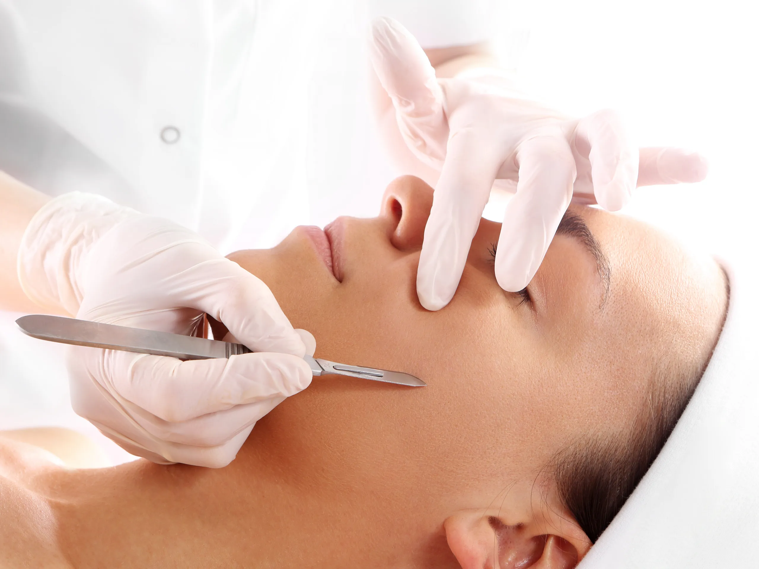 Tratamiento de Dermaplaning - Bioestimulación