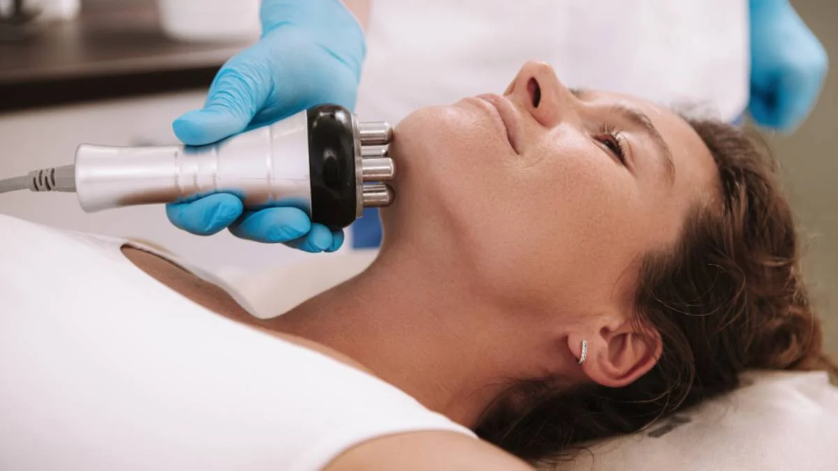 Tratamiento de Radiofrecuencia - Bioestimulación